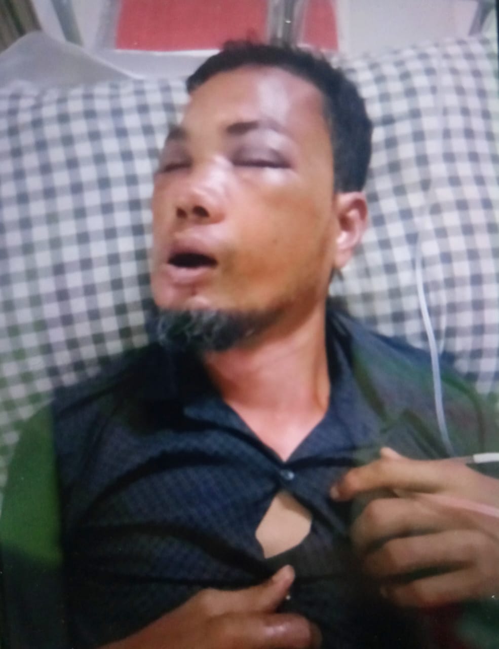 বরগুনায় ট্রাফি গাড়ির ধাক্কায় মোটরসাইকেল চালক মিরাজ গুরুতর আহত